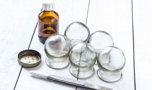The Benefits of Cupping Therapy