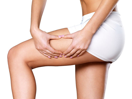 16 Of The Best Ways To Treat Cellulite Naturally